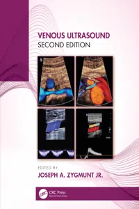 Venous Ultrasound_cover