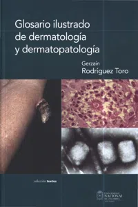 Glosario ilustrado de dermatología y dermatopatología_cover