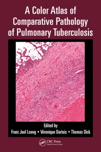 A Color Atlas of Comparative Pathology of Pulmonary Tuberculosis_cover