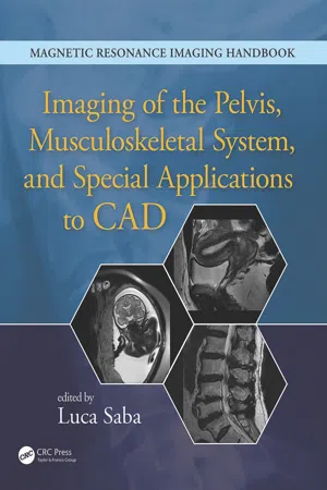 Imaging of the Pelvis, Musculoskeletal System, and Special Applications to CAD