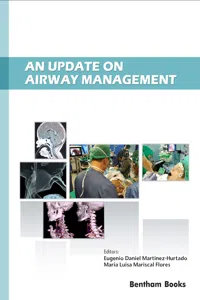 An Update on Airway Management_cover