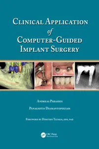 Clinical Application of Computer-Guided Implant Surgery_cover