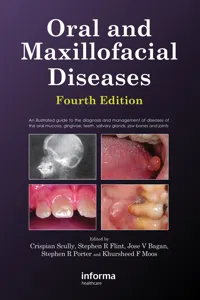 Oral and Maxillofacial Diseases_cover