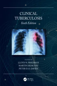 Clinical Tuberculosis_cover