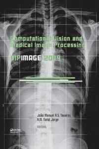 Computational Vision and Medical Image Processing_cover