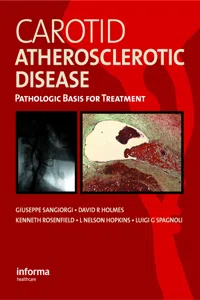 Carotid Atherosclerotic Disease_cover