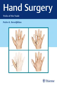 Hand Surgery_cover