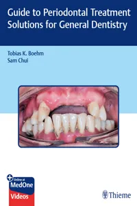 Guide to Periodontal Treatment Solutions for General Dentistry_cover