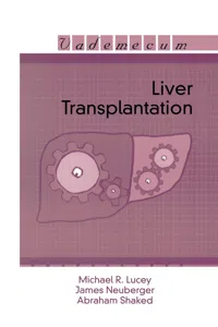 Liver Transplantation_cover