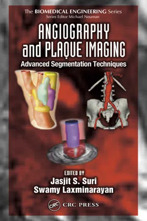 Angiography and Plaque Imaging