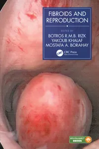 Fibroids and Reproduction_cover