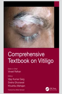 Comprehensive Textbook on Vitiligo_cover