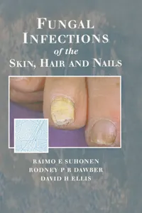 Fungal Infections of the Skin and Nails_cover