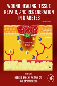 Wound Healing, Tissue Repair, and Regeneration in Diabetes_cover