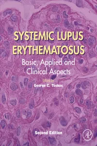 Systemic Lupus Erythematosus_cover
