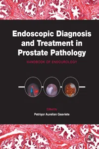 Endoscopic Diagnosis and Treatment in Prostate Pathology_cover