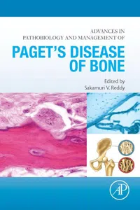Advances in Pathobiology and Management of Paget's Disease of Bone_cover