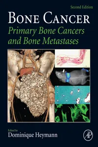 Bone Cancer_cover