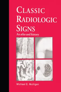 Classic Radiologic Signs_cover