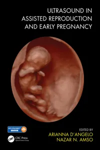 Ultrasound in Assisted Reproduction and Early Pregnancy_cover