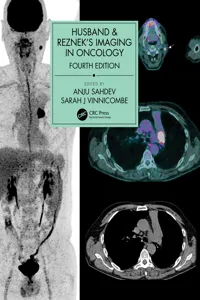 Husband & Reznek's Imaging in Oncology_cover