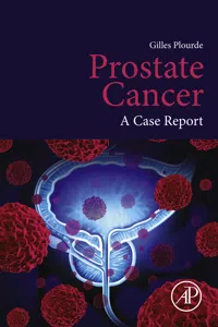 Prostate Cancer_cover