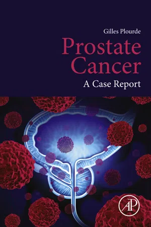 Prostate Cancer