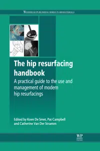 The Hip Resurfacing Handbook_cover