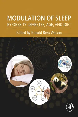 Modulation of Sleep by Obesity, Diabetes, Age, and Diet