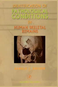 Identification of Pathological Conditions in Human Skeletal Remains_cover