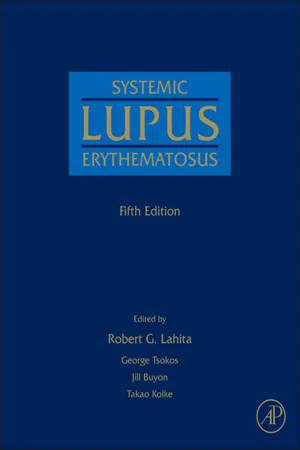 Systemic Lupus Erythematosus