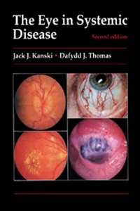 The Eye in Systemic Disease_cover
