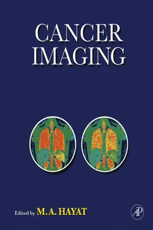 Cancer Imaging