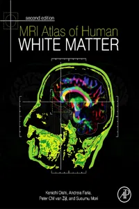 MRI Atlas of Human White Matter_cover