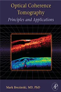 Optical Coherence Tomography_cover