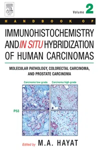 Handbook of Immunohistochemistry and in Situ Hybridization of Human Carcinomas_cover