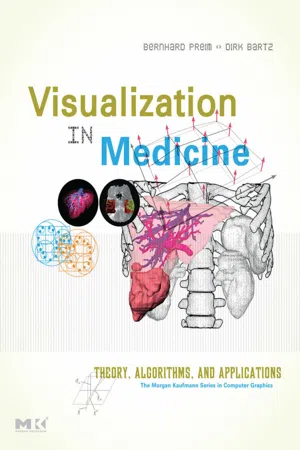 Visualization in Medicine