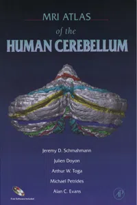 MRI Atlas of the Human Cerebellum_cover