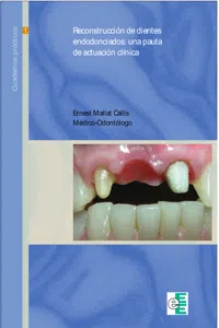 Reconstrucción de dientes endodonciados_cover