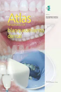 Atlas terapéutico de blanqueamiento dental_cover