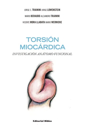 Torsión miocárdica