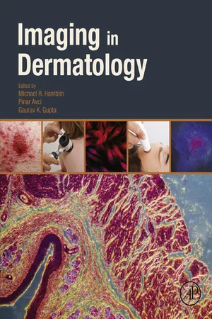 Imaging in Dermatology