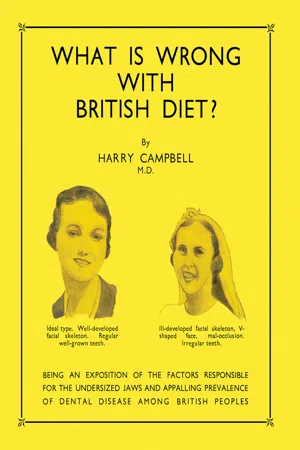 What Is Wrong with British Diet?