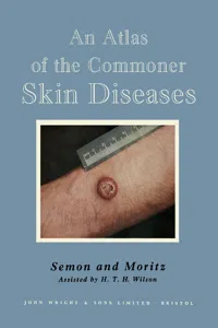 An Atlas of the Commoner Skin Diseases_cover
