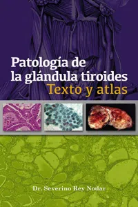 Patología de la glándula tiroides_cover