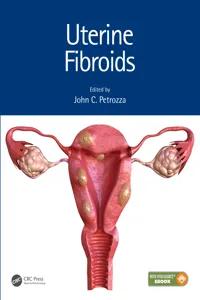 Uterine Fibroids_cover