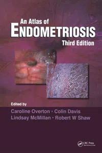 Atlas of Endometriosis_cover