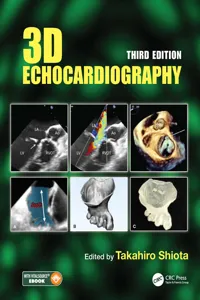 3D Echocardiography_cover