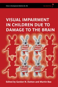 Visual Impairment in Children due to Damage to the Brain_cover