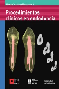 Procedimientos clínicos en endodoncia_cover